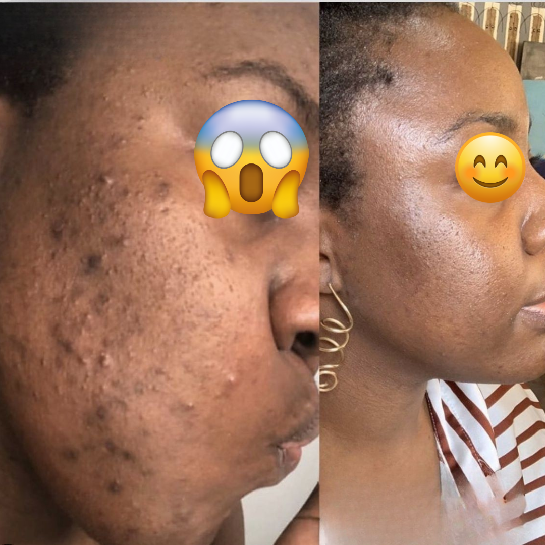 Sérum Anti-Tache Visage - Kora Market 